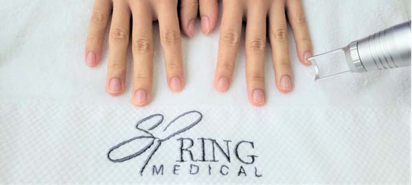 Laser Nail Fungus Therapy