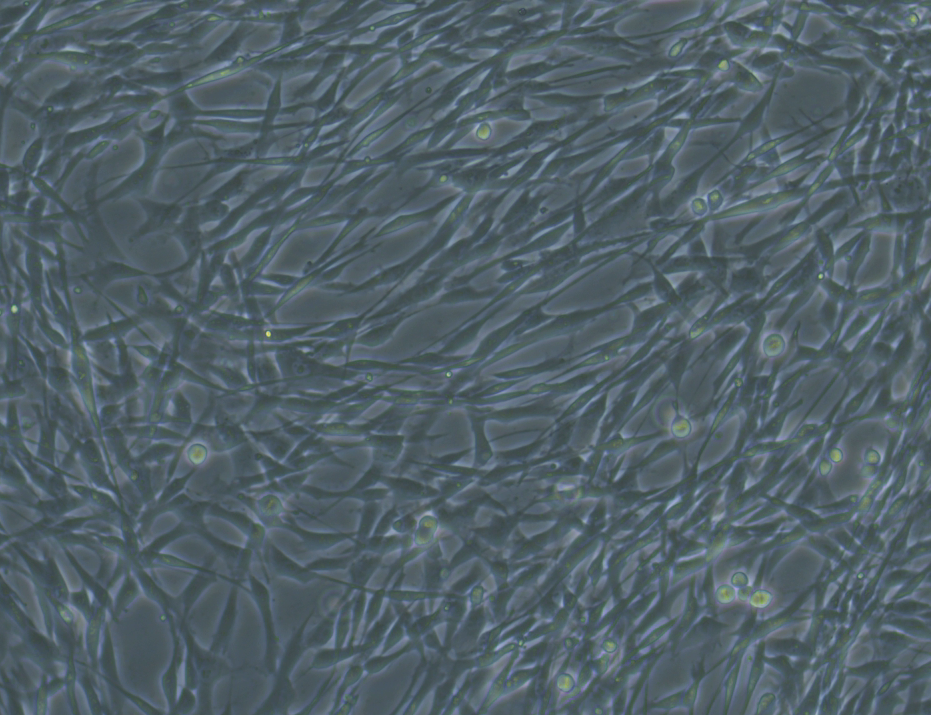 SASP and stem-cell exhaustion