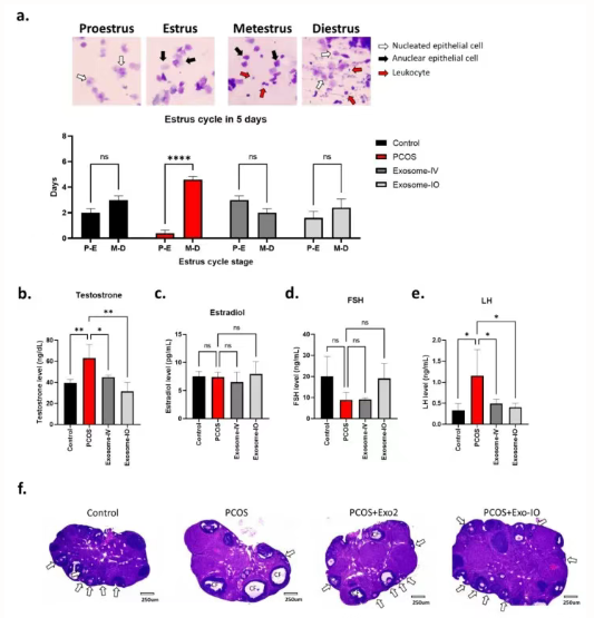 Stem cells and polycystic ovary syndrome