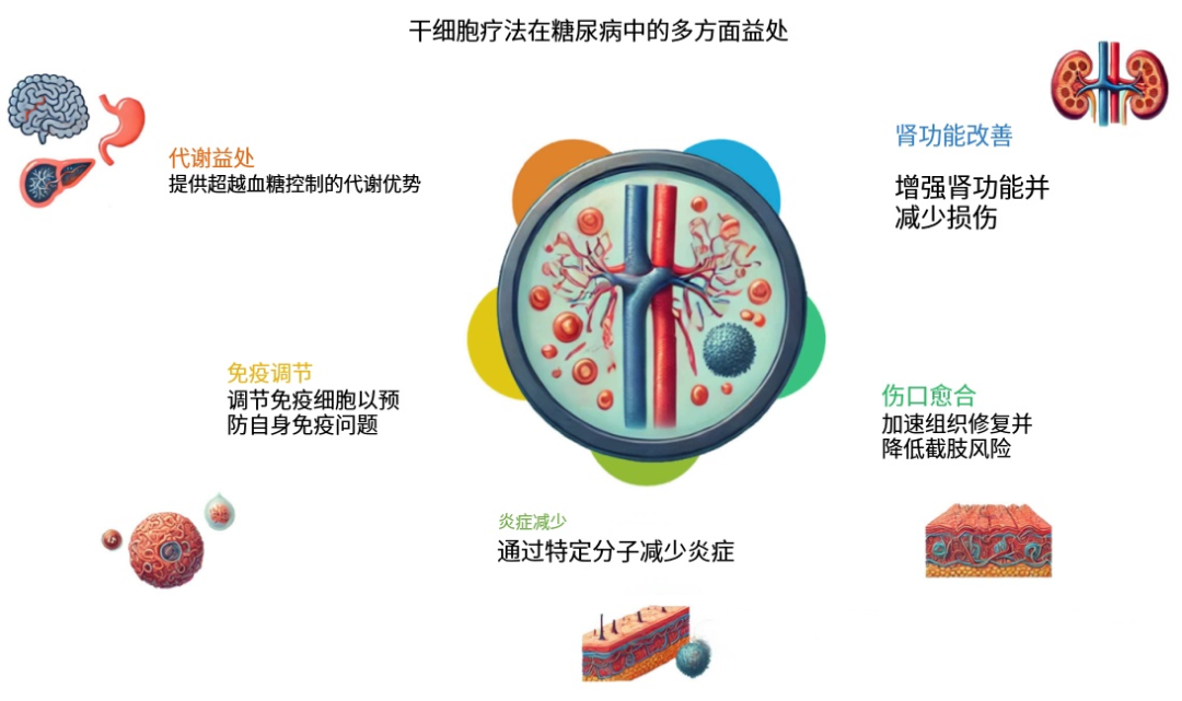 Mechanisms of MSC therapy in type 2 diabetes